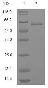 Influenza B Virus Nucleocapsid Protein (Recombinant 10His, N-terminus)