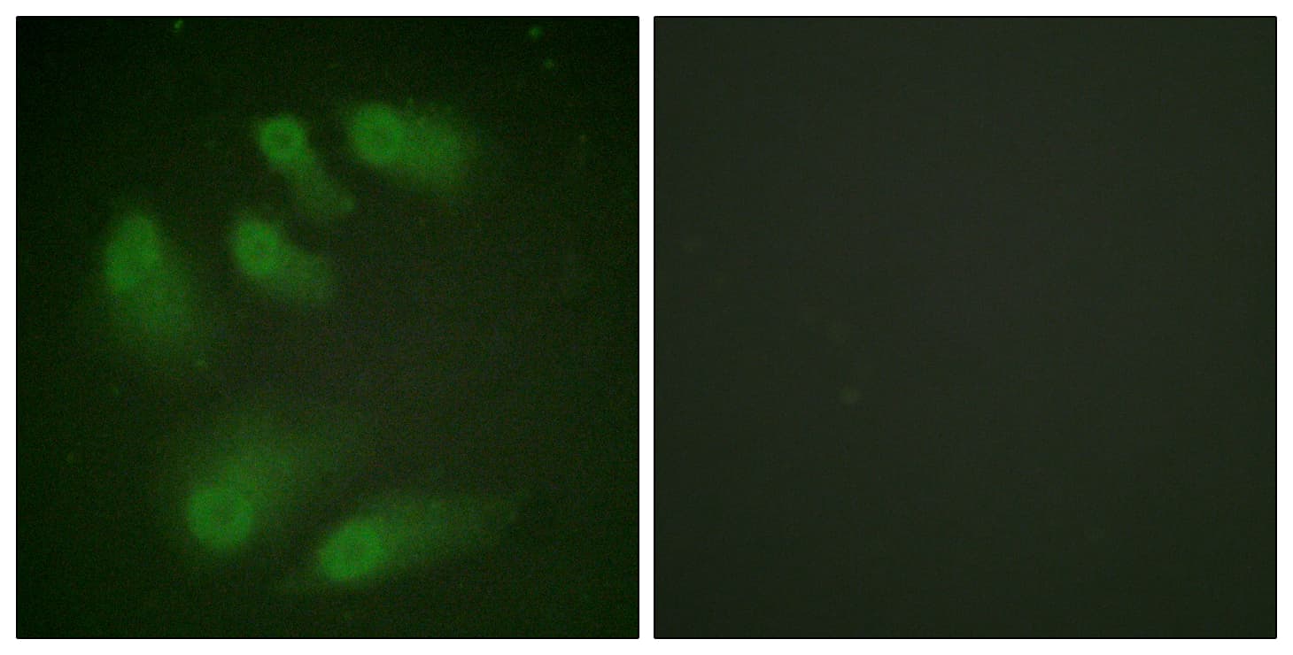 Polyclonal Rabbit anti-Human CHEK1 / CHK1 Antibody (phospho-Ser286, IF, WB)