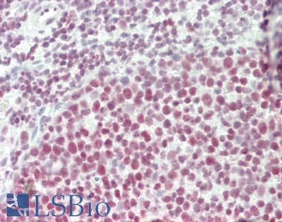 IHC-plus™ SNRPD3 Antibody (aa76-126)