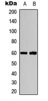 AKT1 + AKT2 Antibody (phospho-Thr308/Thr309)