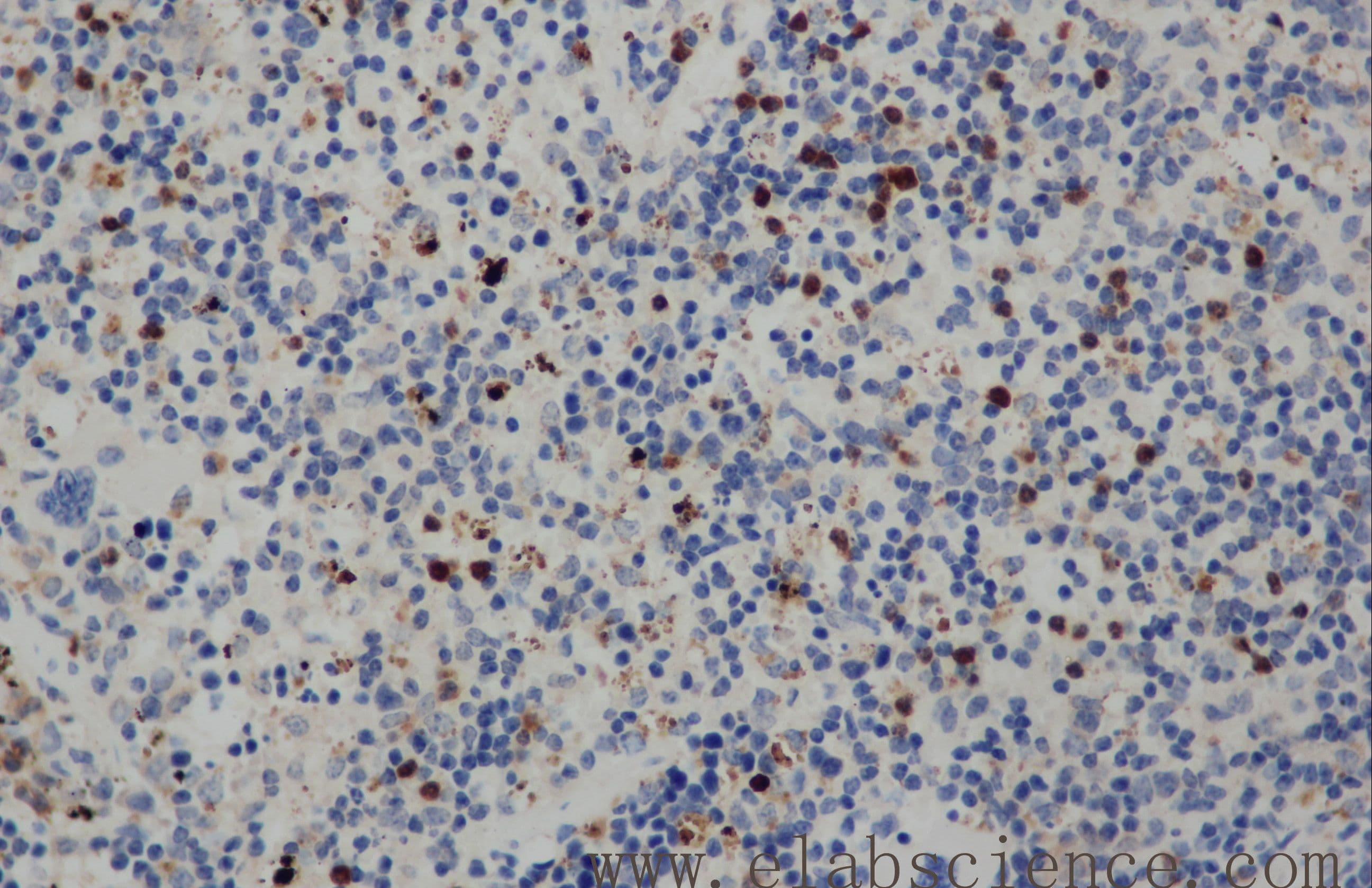 CD68 Antibody