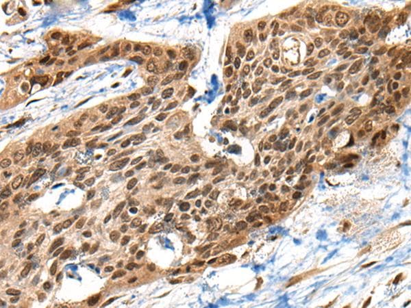 Polyclonal Rabbit anti-Human XPO1 / CRM1 Antibody (IHC, WB)