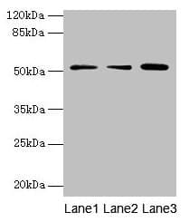 Polyclonal Rabbit anti-Human ACSBG2 Antibody (IHC, WB)