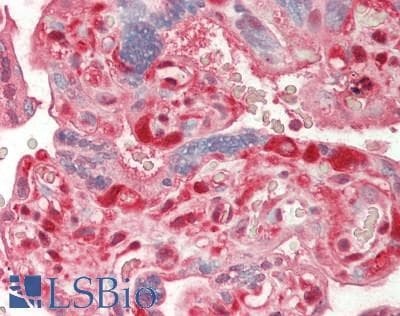 PathPlus™ Monoclonal Mouse anti-Human PARK7 / DJ-1 Antibody (clone 4H4, IHC, IF, WB)