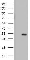 Monoclonal Mouse anti-Human HADH Antibody (clone OTI6F10, aa57-314, WB)