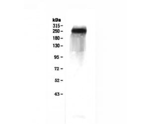 Polyclonal Rabbit anti-Human F5 / Factor Va Antibody (WB)