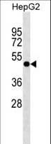 Polyclonal Rabbit anti-Human PLEKHA8 Antibody (aa456-482, WB)