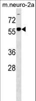 B4GALNT1 / GM2/GD2 Synthase Antibody (aa296-323)