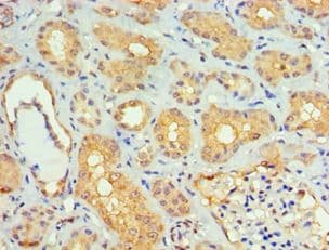 SMAD9 Antibody (aa1-300)
