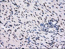 RPA2 / RFA2 / RPA34 Antibody (clone OTI8B3)