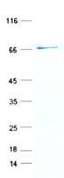 Human FOXF1 Protein (Recombinant GST, N-terminus + His, C-terminus)