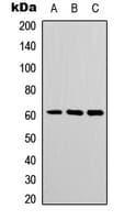 POTEH Antibody (Internal)