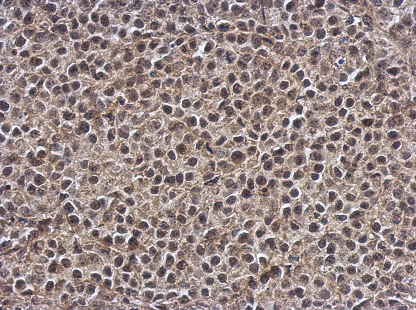 SMG7 Antibody