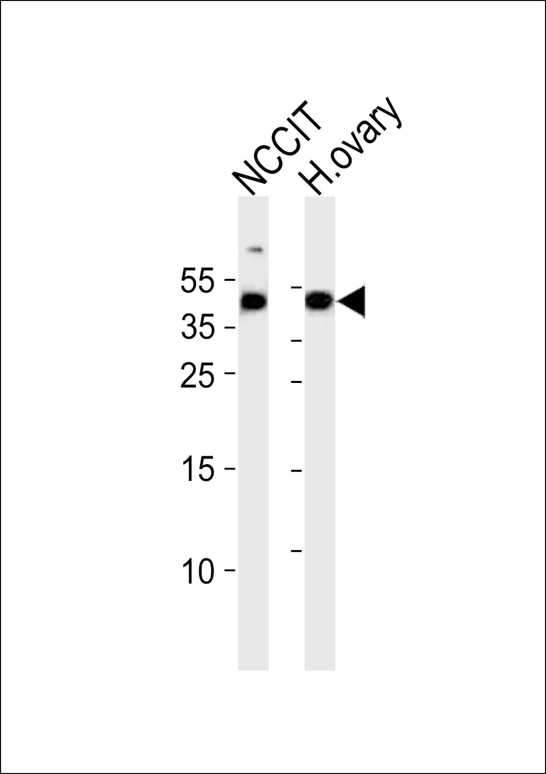 ESRG Antibody (Internal)