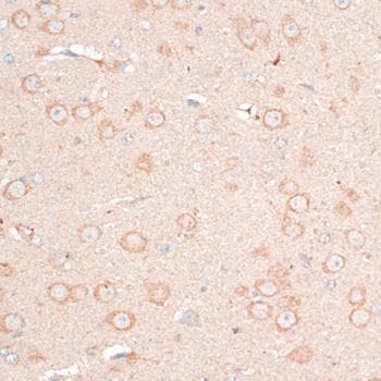 CDH18 / Ey-Cadherin Antibody