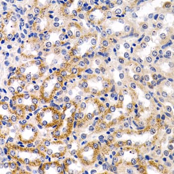 CYP24 / CYP24A1 Antibody