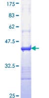 Human IL24 Protein (Recombinant GST, N-terminus)