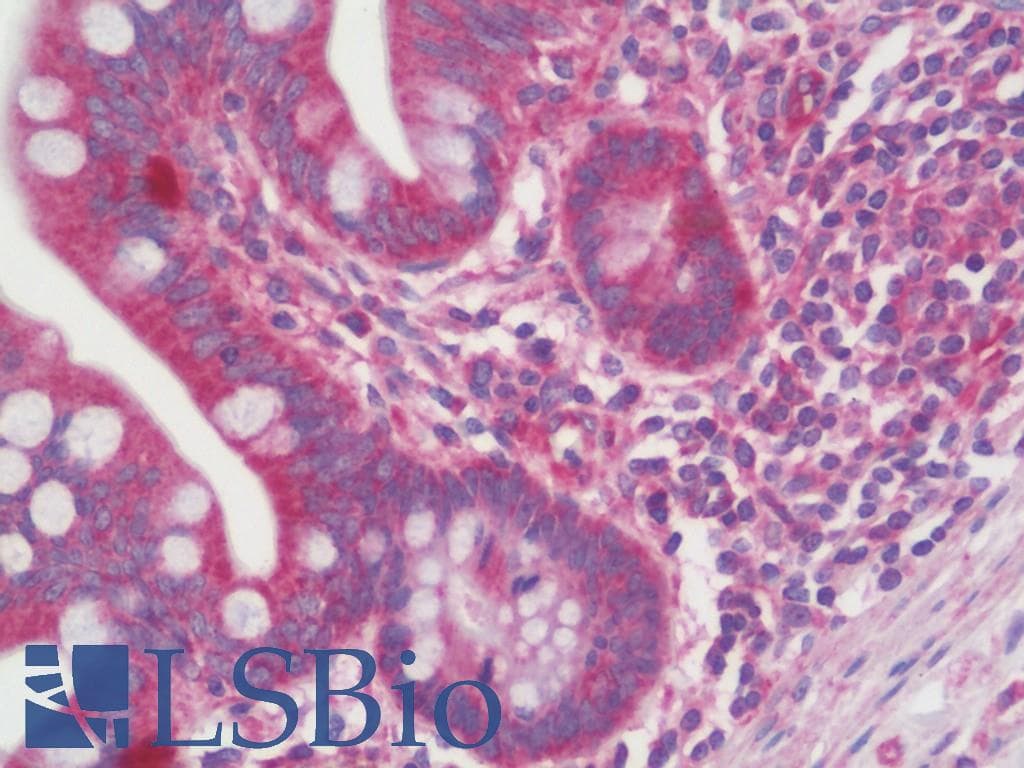 IHC-plus™ S100A16 Antibody (aa1-50)
