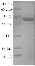 Human TRP32 / TXNL1 Protein (Recombinant 6His-SUMO, N-terminus)
