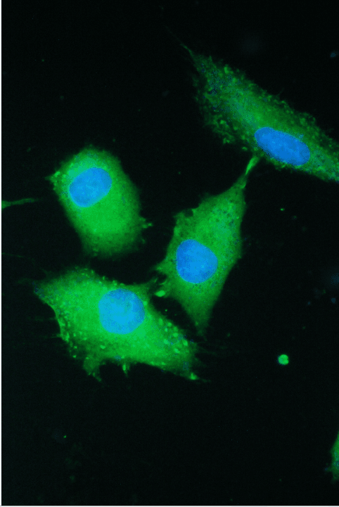 PARN Antibody