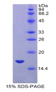 Human MYL7 Protein (Recombinant His)