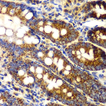 TNFSF11 / RANKL / TRANCE Antibody