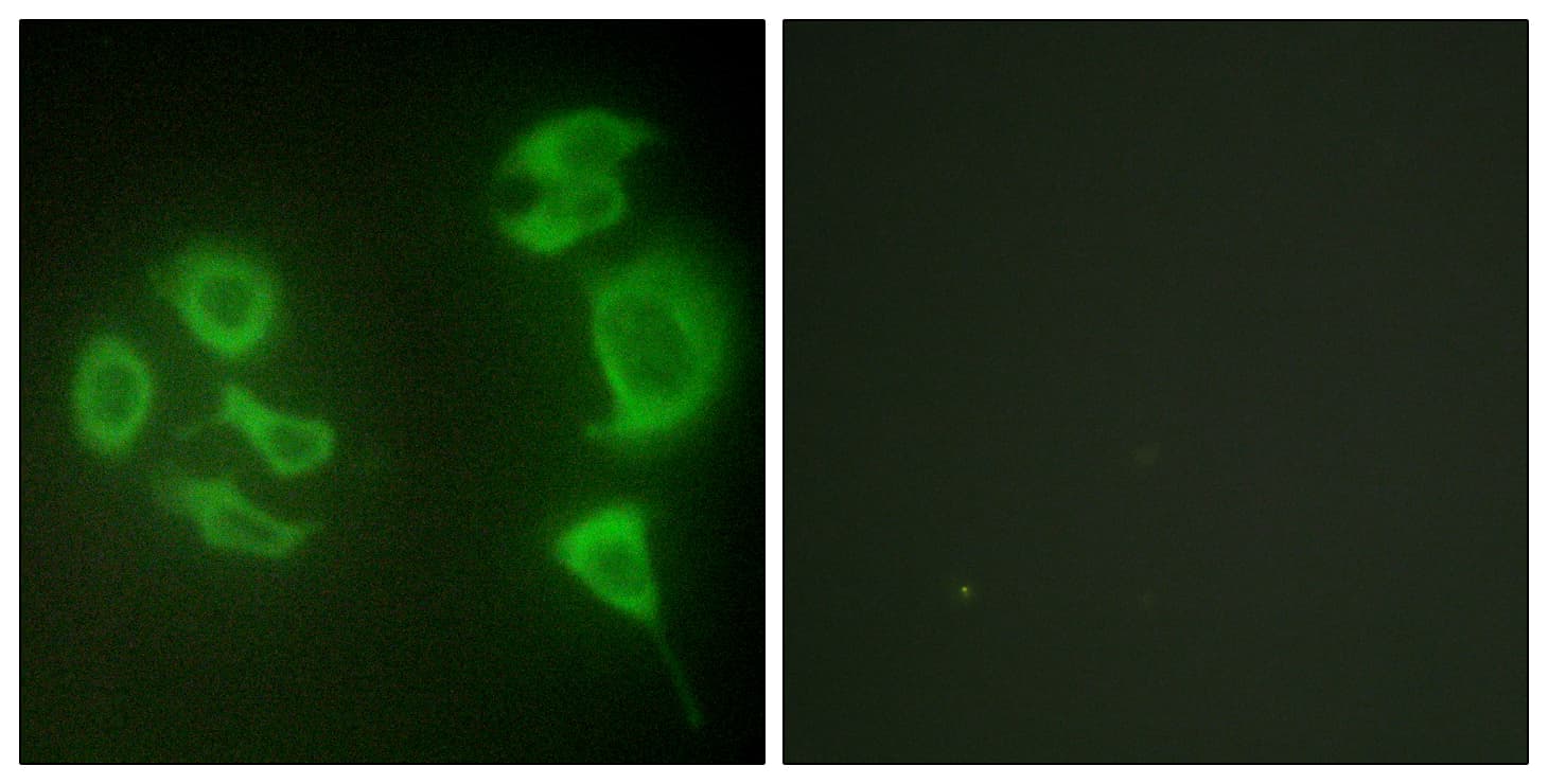 Polyclonal Rabbit anti-Human ZAK / MLTK Antibody (aa701-750, IF, WB)