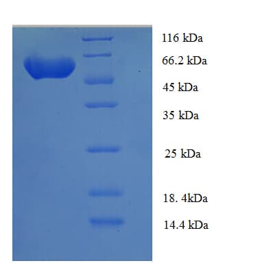 Human NIM1K / NIM1 Protein (Recombinant His-SUMO)