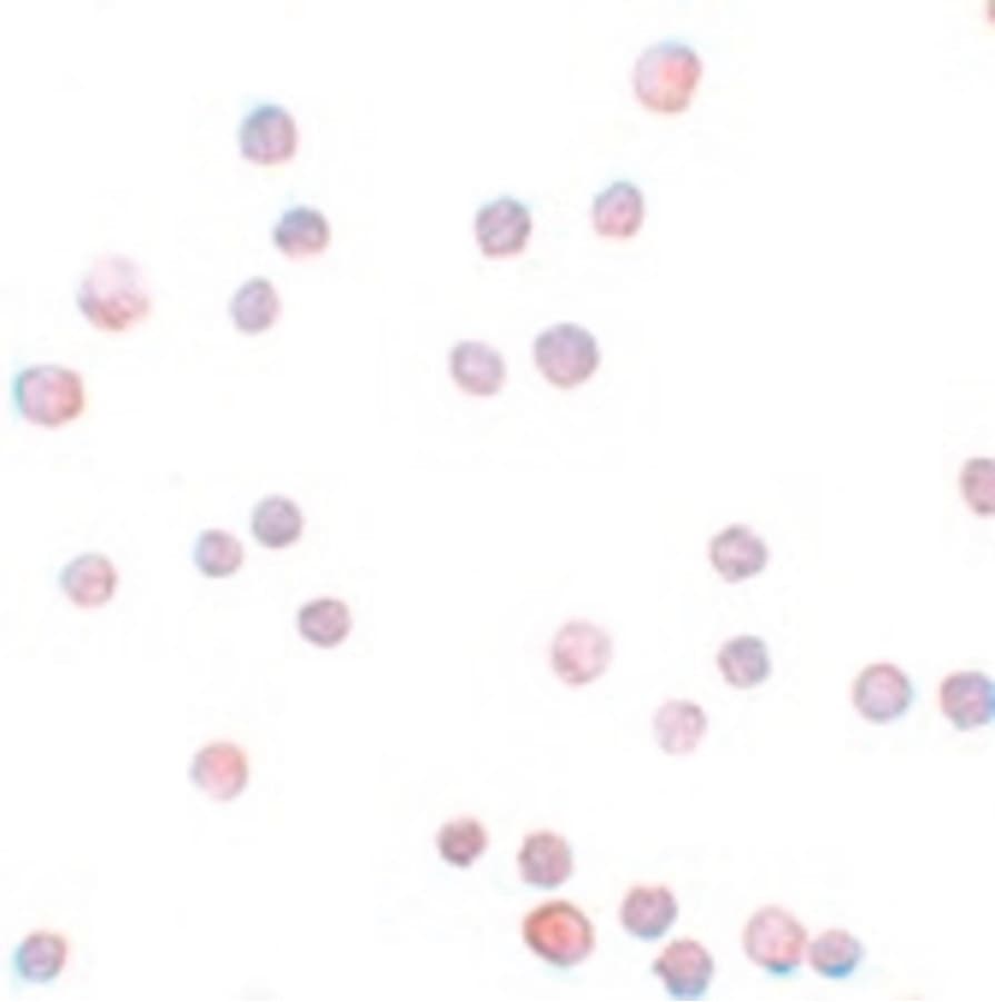 ZEB1 / AREB6 Antibody