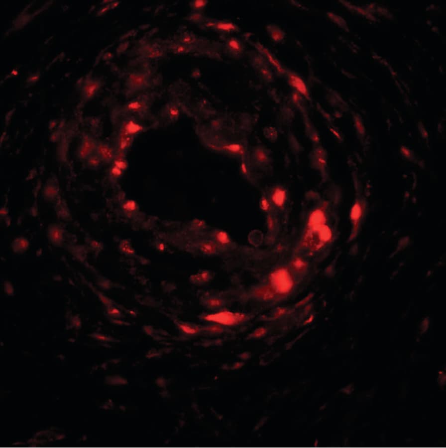 TSPAN20 / UPK1B Antibody
