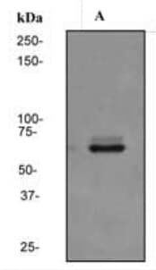 Polyclonal Rabbit anti-Human TGFBR2 Antibody (IHC, WB)