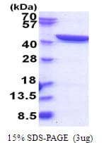 Human GFPT1 / GFAT Protein (Recombinant His)