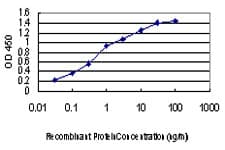 MAP3K1 / MEKK1 Antibody (clone 2F6)