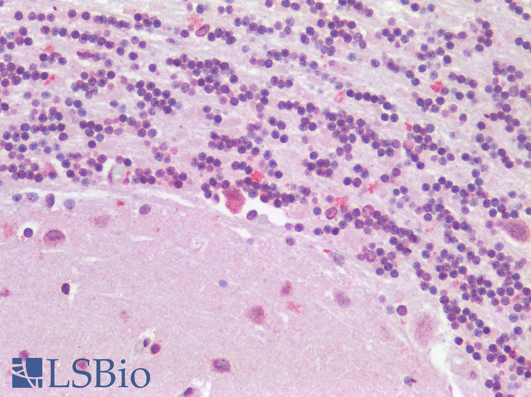 IHC-plus™ Polyclonal Goat anti-Human TP53BP1 / 53BP1 Antibody (aa350-400, IHC)