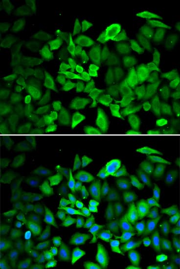 Polyclonal Rabbit anti-Human ANXA1 / Annexin A1 Antibody (IHC, IF, WB)