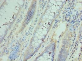 Polyclonal Rabbit anti-Human CCT3 Antibody (aa1-300, IHC, WB)