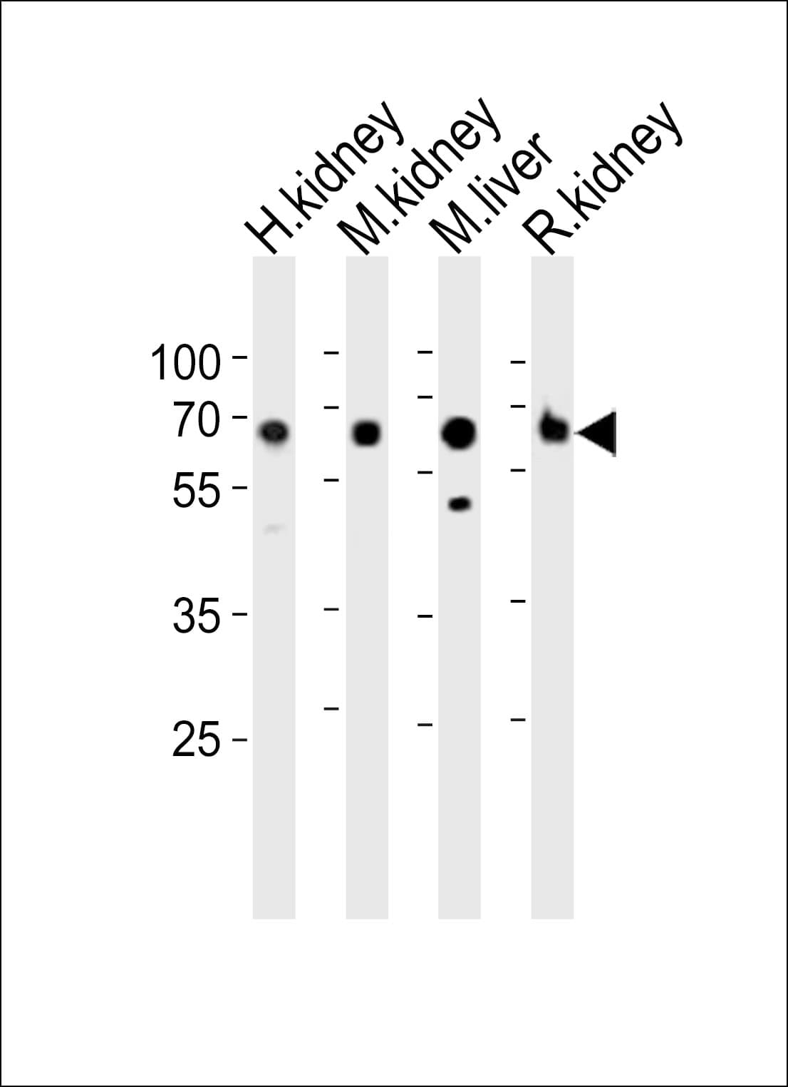 ACSM5 / MACS3 Antibody (aa562-596)