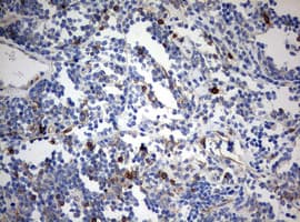 CD99 Antibody (clone OTI1A4)