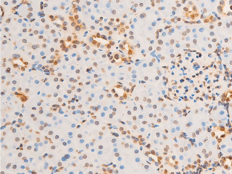 Polyclonal Rabbit anti-Human EIF2S1 Antibody (phospho-Ser51, IHC, IF, WB)