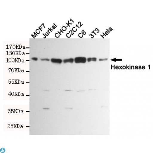 HK1 / Hexokinase 1 Antibody