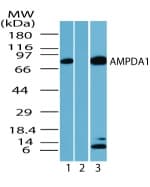 IHC-plus™ AMPD1 Antibody (aa140-190)