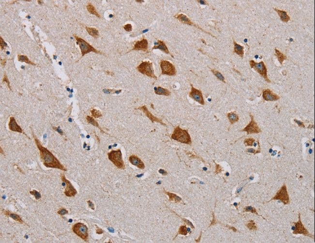 MTCP1NB Antibody