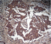 Polyclonal Rabbit anti-Human STAT3 Antibody (IHC, WB)