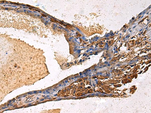 LYAR Antibody