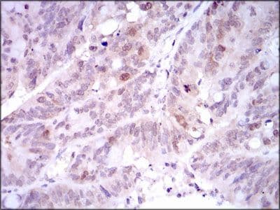 PLK1 / PLK-1 Antibody (Amino Acid: 331-508, clone 3C11)