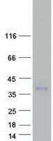Human TARM1 Protein (Recombinant Myc-DDK (Flag))