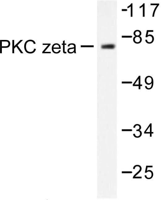 PRKCZ / PKC-Zeta Antibody (Pro556)