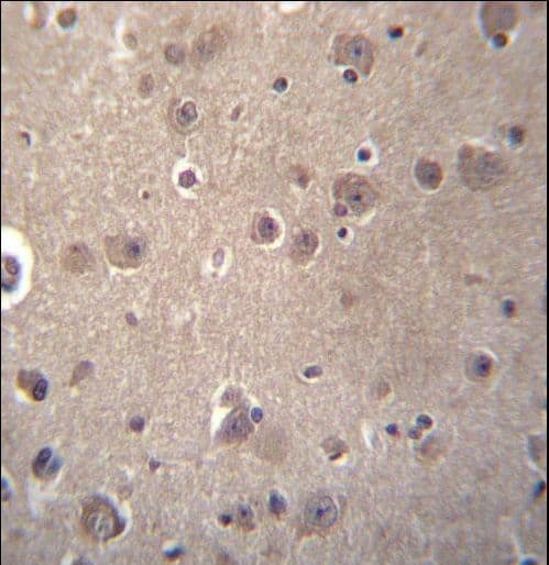SNX4 Antibody (aa391-420)
