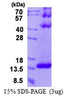 Human DYNLT3 Protein (Recombinant His)