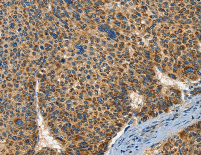 IFT74 / CCDC2 Antibody